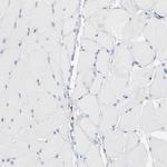 SH3KBP1 Antibody in Immunohistochemistry (IHC)