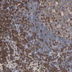 SH3KBP1 Polyclonal Antibody