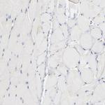 SH3KBP1 Antibody in Immunohistochemistry (IHC)