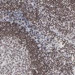 SP2 Antibody in Immunohistochemistry (IHC)