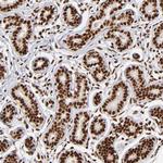 ZNF146 Antibody in Immunohistochemistry (Paraffin) (IHC (P))