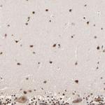 BRPF1 Polyclonal Antibody