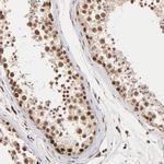 BRPF1 Antibody in Immunohistochemistry (Paraffin) (IHC (P))