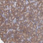 RPS24 Antibody in Immunohistochemistry (Paraffin) (IHC (P))