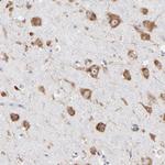 RPL3 Antibody in Immunohistochemistry (Paraffin) (IHC (P))