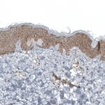 RPLP1 Antibody in Immunohistochemistry (IHC)
