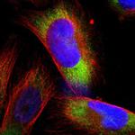 RPS21 Polyclonal Antibody