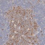 RPS21 Antibody in Immunohistochemistry (IHC)