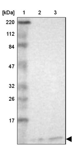 RPS21 Antibody in Western Blot (WB)