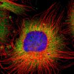 RPL9 Polyclonal Antibody