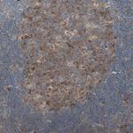 RPL23 Antibody in Immunohistochemistry (Paraffin) (IHC (P))