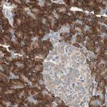 RPL23 Antibody in Immunohistochemistry (Paraffin) (IHC (P))