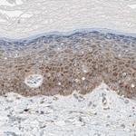 RPL23 Antibody in Immunohistochemistry (Paraffin) (IHC (P))
