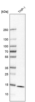 RPL23 Antibody in Western Blot (WB)