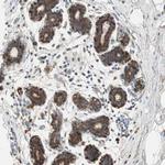 RPL23 Antibody in Immunohistochemistry (IHC)