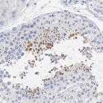 ZCCHC13 Polyclonal Antibody