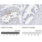 ZCCHC13 Antibody in Immunohistochemistry (IHC)