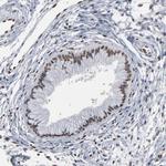 ATF7 Polyclonal Antibody