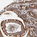 PCNXL4 Antibody in Immunohistochemistry (Paraffin) (IHC (P))