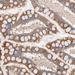 STRN3 Antibody in Immunohistochemistry (Paraffin) (IHC (P))