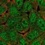 KIAA0323 Polyclonal Antibody