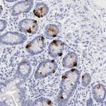 KIAA0323 Antibody in Immunohistochemistry (Paraffin) (IHC (P))