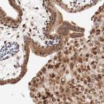 RPL12 Antibody in Immunohistochemistry (Paraffin) (IHC (P))