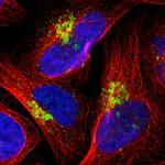 RPL12 Polyclonal Antibody