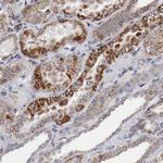 NDUFV2 Antibody in Immunohistochemistry (IHC)