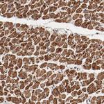 NDUFV2 Antibody in Immunohistochemistry (IHC)
