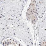 NDUFV2 Polyclonal Antibody