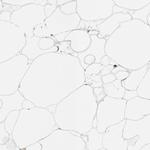 NDUFV2 Antibody in Immunohistochemistry (IHC)