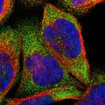 IVNS1ABP Polyclonal Antibody