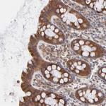 IVNS1ABP Antibody in Immunohistochemistry (Paraffin) (IHC (P))