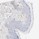 tPA Polyclonal Antibody