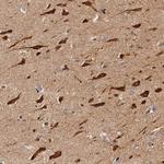 PITPNM2 Antibody in Immunohistochemistry (Paraffin) (IHC (P))