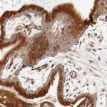 PITPNM2 Antibody in Immunohistochemistry (Paraffin) (IHC (P))