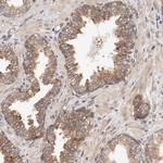 PITPNM2 Antibody in Immunohistochemistry (Paraffin) (IHC (P))