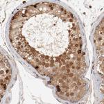 PITPNM2 Polyclonal Antibody