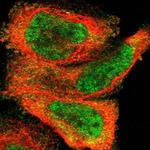 ZDHHC8 Antibody in Immunocytochemistry (ICC/IF)
