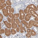 ZDHHC8 Antibody in Immunohistochemistry (Paraffin) (IHC (P))