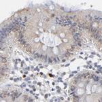 Nesprin 2 Antibody in Immunohistochemistry (IHC)