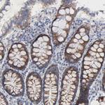 CHCHD10 Antibody in Immunohistochemistry (IHC)