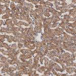 CHCHD10 Antibody in Immunohistochemistry (IHC)