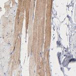 CHCHD10 Antibody in Immunohistochemistry (IHC)