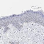 CHCHD10 Antibody in Immunohistochemistry (IHC)