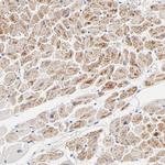 CHCHD10 Antibody in Immunohistochemistry (IHC)