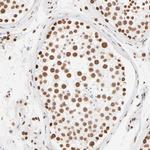 ZNF540 Antibody in Immunohistochemistry (Paraffin) (IHC (P))