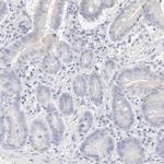 HNF6 Antibody in Immunohistochemistry (IHC)