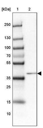 HNF6 Antibody in Western Blot (WB)